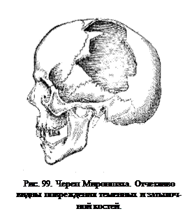 Краниологической основе - student2.ru