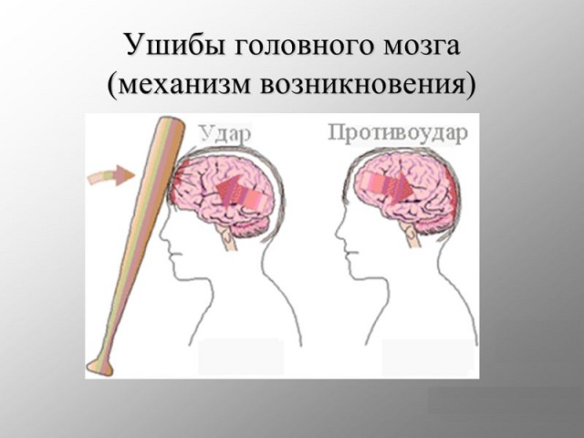 Типичное положение «лягушечьих лап» Поперечное сдавливание таза за гребни подвздошных костей - student2.ru