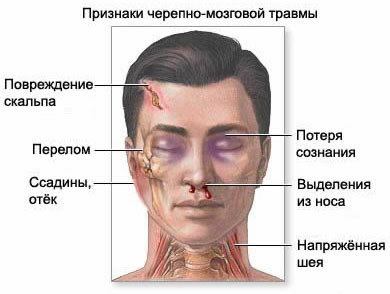 Типичное положение «лягушечьих лап» Поперечное сдавливание таза за гребни подвздошных костей - student2.ru