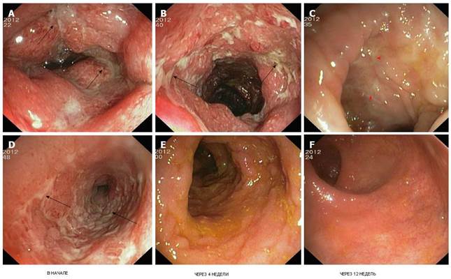 Гистологические и эндоскопические характеристики - student2.ru