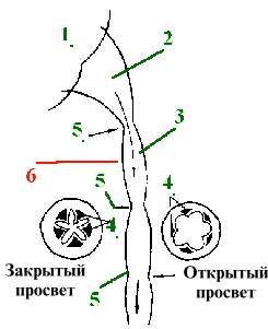 I. Цистоиды (сегменты) мочевыводящих путей - student2.ru