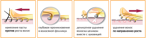 Как избежать врастания волос? - student2.ru