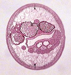 ленточные черви - паразиты человека. - student2.ru