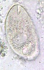 Лямблия Lamblia intestinalis - student2.ru