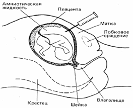 Методы рекомбинантной ДНК. - student2.ru