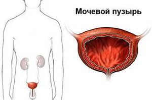 Мочевыделительная система человека - student2.ru