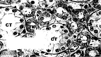 Почка, гематоксилин - эозин. - student2.ru