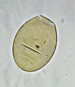 Работа 19.4. Препарат яиц Fasciola hepatica - student2.ru