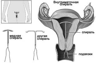 Симптотермальный метод - student2.ru