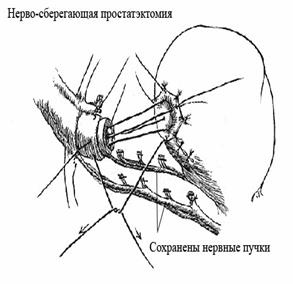 Уық асты без рагын емдеу әдістері - student2.ru