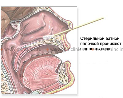 Виділення чистої культури стафілококів із слизової носа - student2.ru