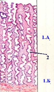 Эндометрий. I. Гистологические слои эндометрия: эпителий и собственная пластинка 5,а-в. Препарат - матка кошки; поперечный разрез. Окраска гематоксилин-эозином. - student2.ru