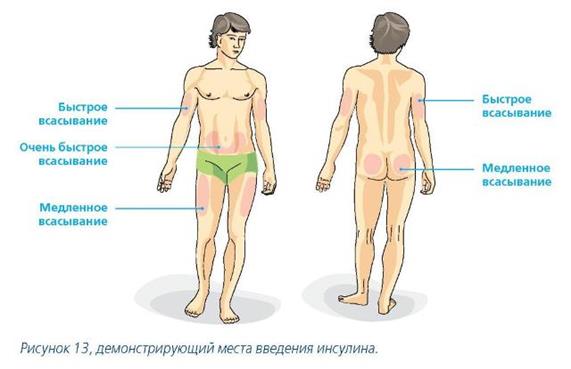 Инсулины короткого действия прозрачны. Во флаконах находятся 5 мл, реже 10 мл. В 1 мл содержится 40 ЕД - student2.ru