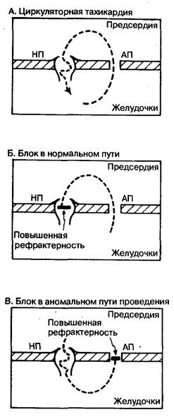 Купирование острого приступа - student2.ru