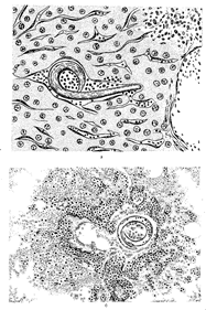 Аскарида человеческая (Ascaris lumbricoides) - student2.ru