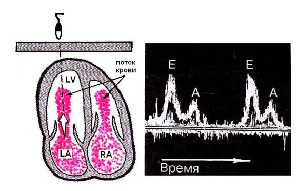 Допплеровская эхокардиография - student2.ru