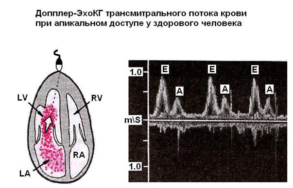 Допплеровская эхокардиография - student2.ru