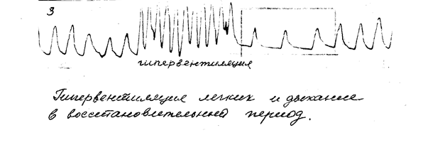 Функциональная схема формирования слова, фонемы - student2.ru