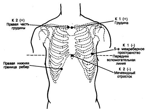 Аппаратура для холтеровского мониторирования - student2.ru