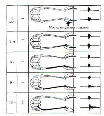 глава 20 патофизиология нервной системы - student2.ru