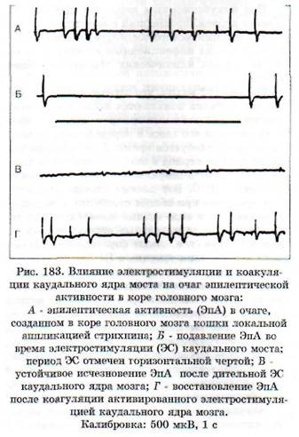 глава 20 патофизиология нервной системы - student2.ru