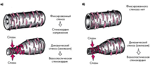 Хирургические методы реваскуляризации миокарда - student2.ru