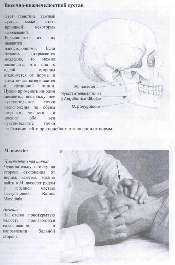 Латеральный стрейн сфенобазилярного симфиза - student2.ru