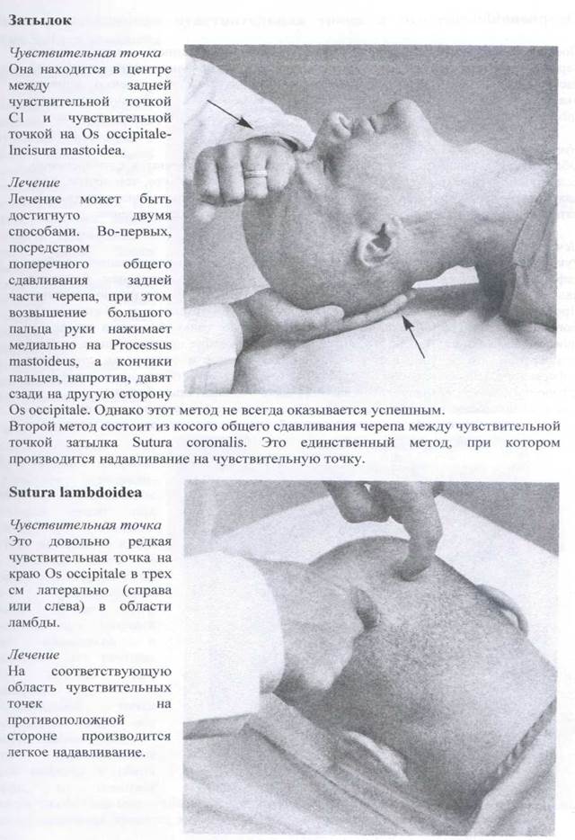 Латеральный стрейн сфенобазилярного симфиза - student2.ru