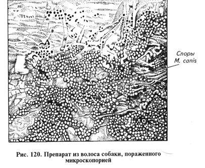 микозов, вызываемых плесневыми и дрожжеподобными грибами. биопрепараты - student2.ru