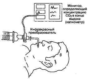 Мониторинг концентрации углекислого газа в конце выдоха (капнография) - student2.ru