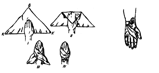 Мягкие безбинтовые повязки и техника их наложения - student2.ru