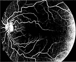 Сосудистая система сетчатки - student2.ru