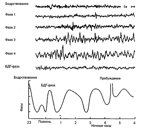 Стадии медленного сна и быстрый сон - student2.ru