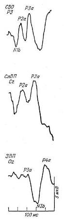 Усредненные вызванные потенциалы - student2.ru
