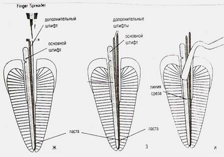 Введение в корневой канал эндогерметика - student2.ru