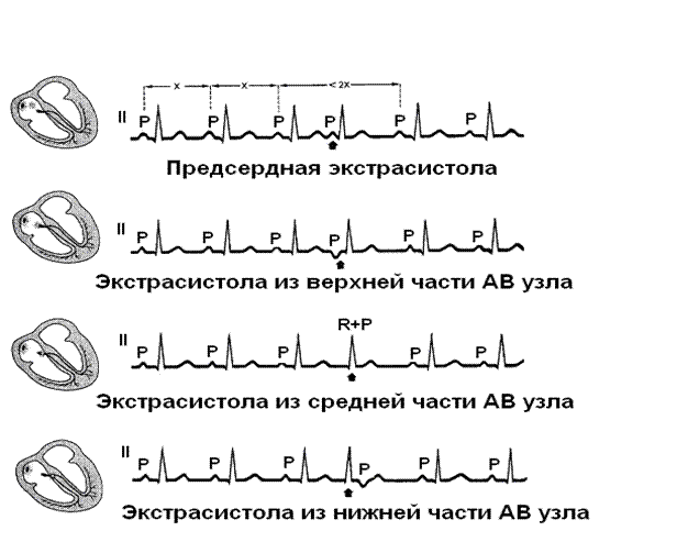 Этап. Анализ зубцов, сегмента ST и вольтажа - student2.ru