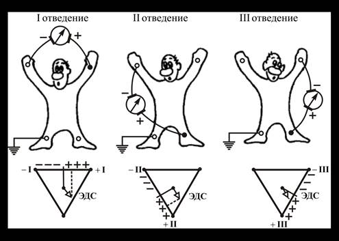 Электрокардиографические отведения - student2.ru