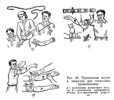 Приемы и способы остановки кровотечений, правила наложения повязок при ранениях - student2.ru