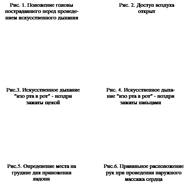 Закрытый (непрямой) массаж сердца - student2.ru