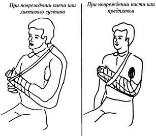 Растяжения и разрывы связок. Пострадавший испытывает сильную боль, появляется припухлость, движения ограничены из-за боли - student2.ru