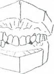 заміщені або ні протезами відсутні зуби - student2.ru
