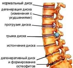 Почему при лечении не чувствуется болезненных ощущений а только лёгкое покалывание пульсация или зуд? - student2.ru