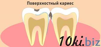 Поверхностный кариес. Клиника, дифференциальная диагностика и лечение. - student2.ru