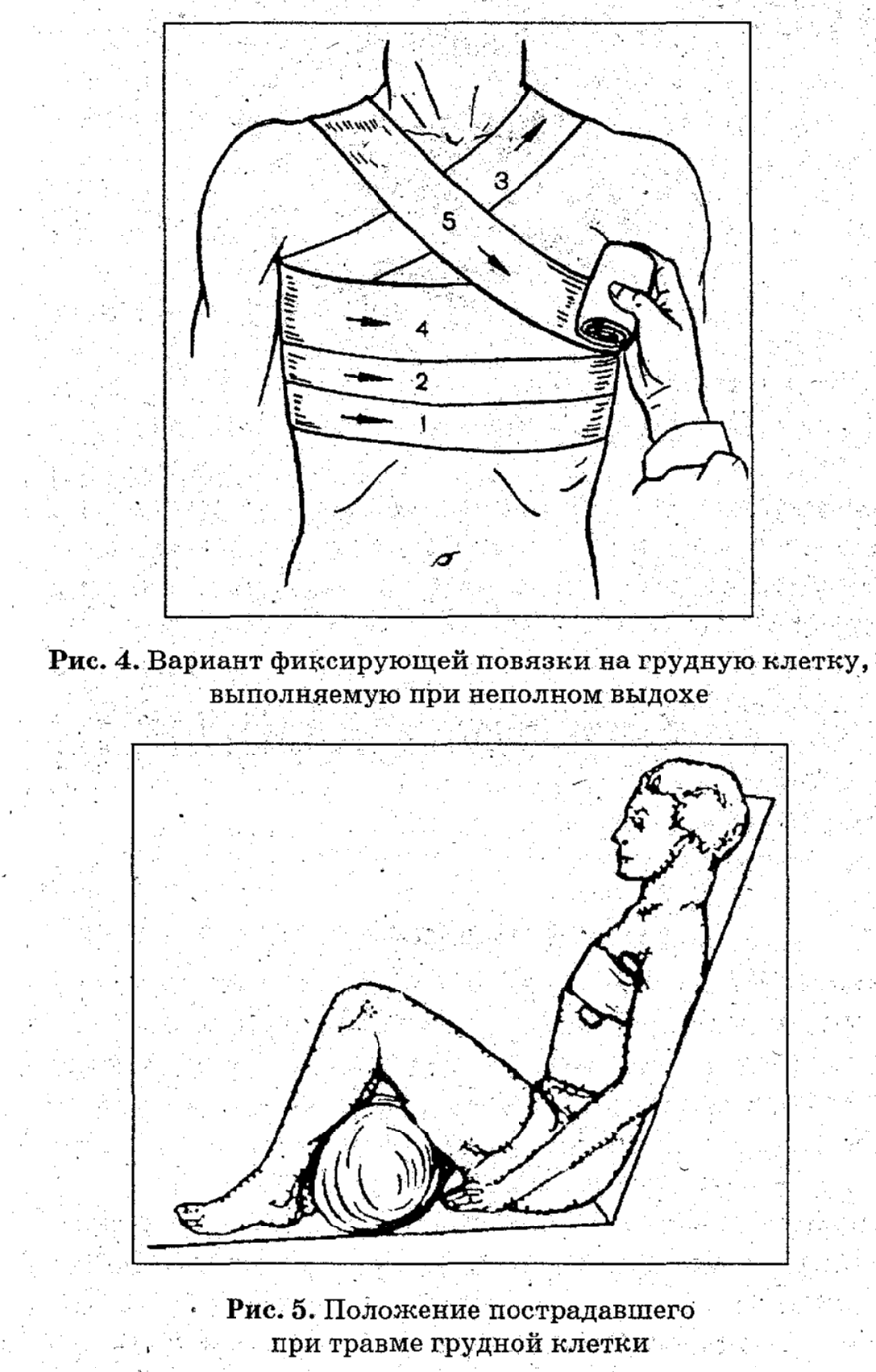 Проникающее ранение грудной клетки. - student2.ru