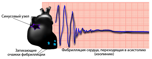 Слайд. Электрическая активность сердца - student2.ru