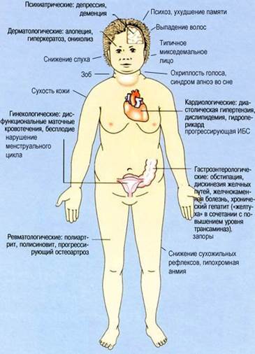 Тема: "Сестринский уход при заболеваниях эндокринной системы (гипотиреоз)". - student2.ru