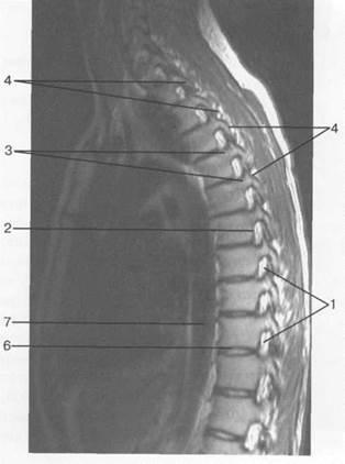 лучевая анатомия позвоночника и спинного мозга - student2.ru