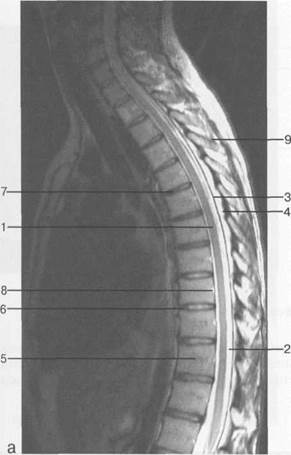 лучевая анатомия позвоночника и спинного мозга - student2.ru