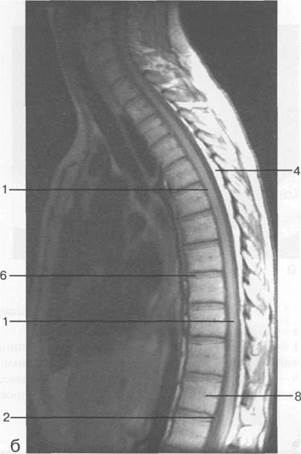 лучевая анатомия позвоночника и спинного мозга - student2.ru