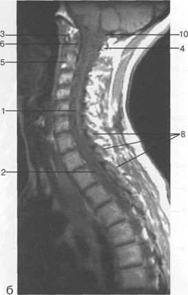 лучевая анатомия позвоночника и спинного мозга - student2.ru